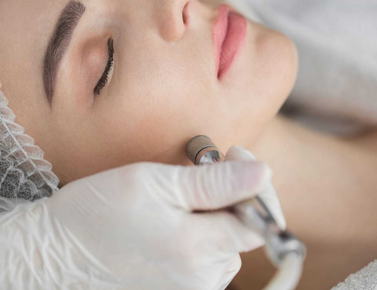 Facial treatment with a microdermabrasion tool on a woman's relaxed face.